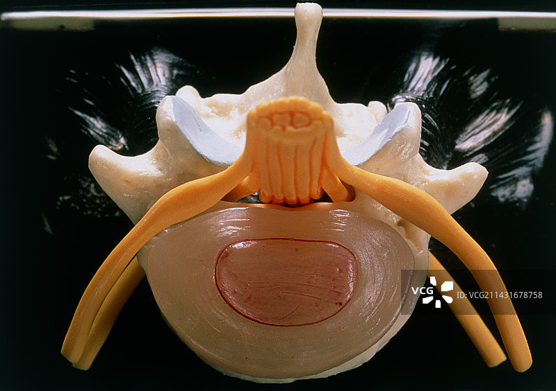人体脊柱的椎间盘模型图片素材