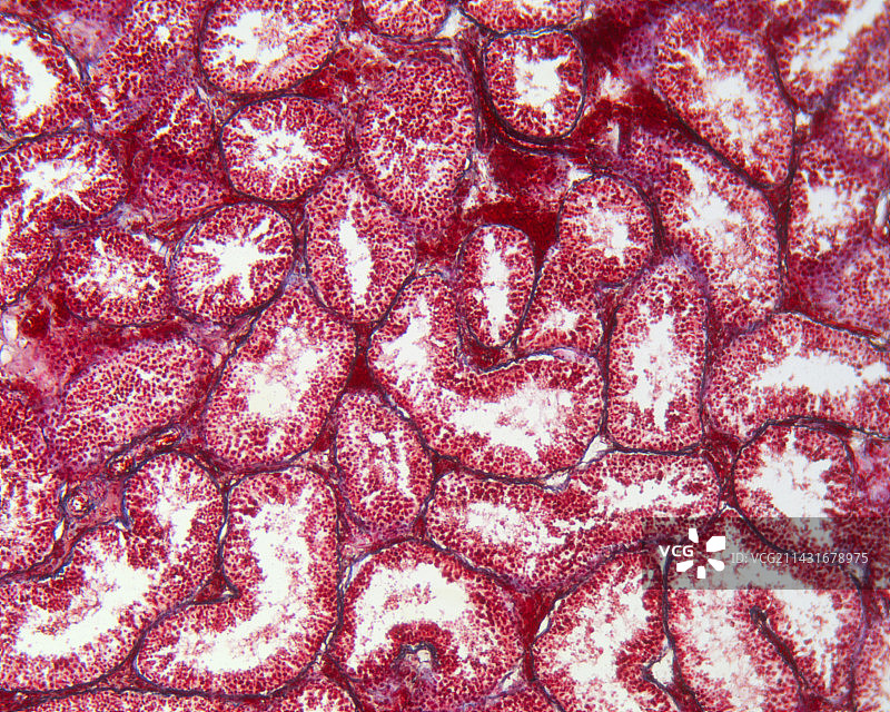 人类睾丸生精小管图片素材