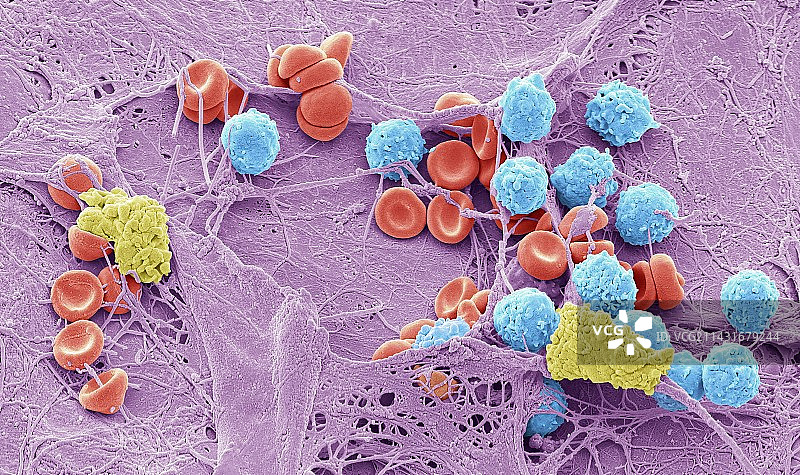 皮肤伤口扫描电镜图图片素材