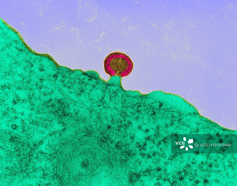 淋巴组织中的艾滋病毒感染，透射电镜图片素材