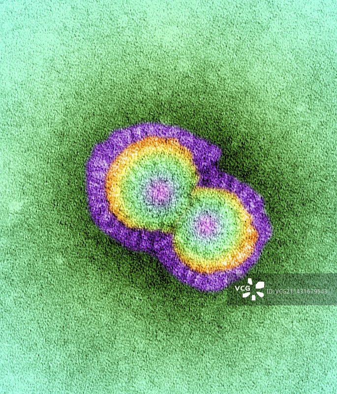 H5N1禽流感病毒颗粒（透射电镜）图片素材