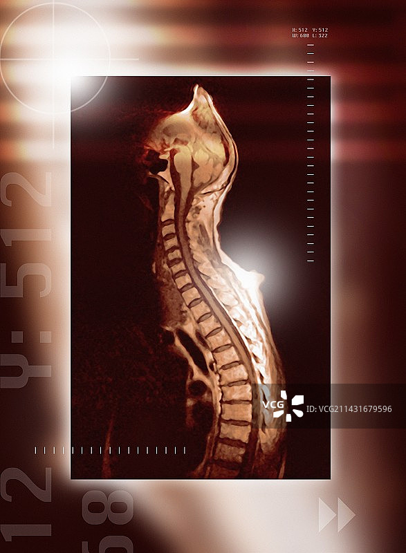健康的脊椎核磁共振扫描图片素材