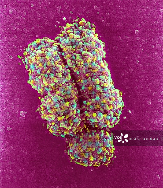 染色体，扫描电镜图片素材