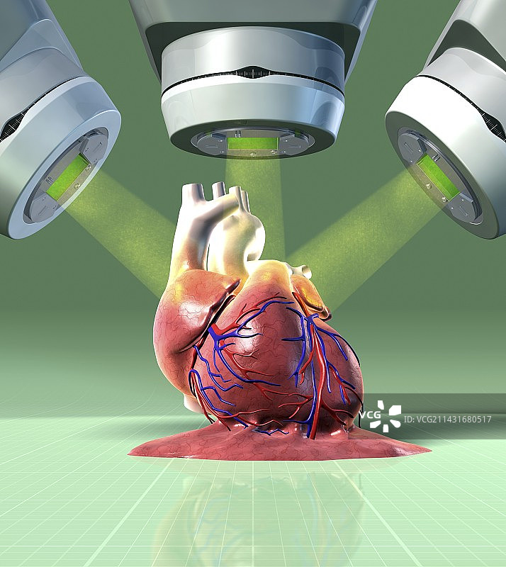 放射治疗损伤的心脏艺术作品图片素材