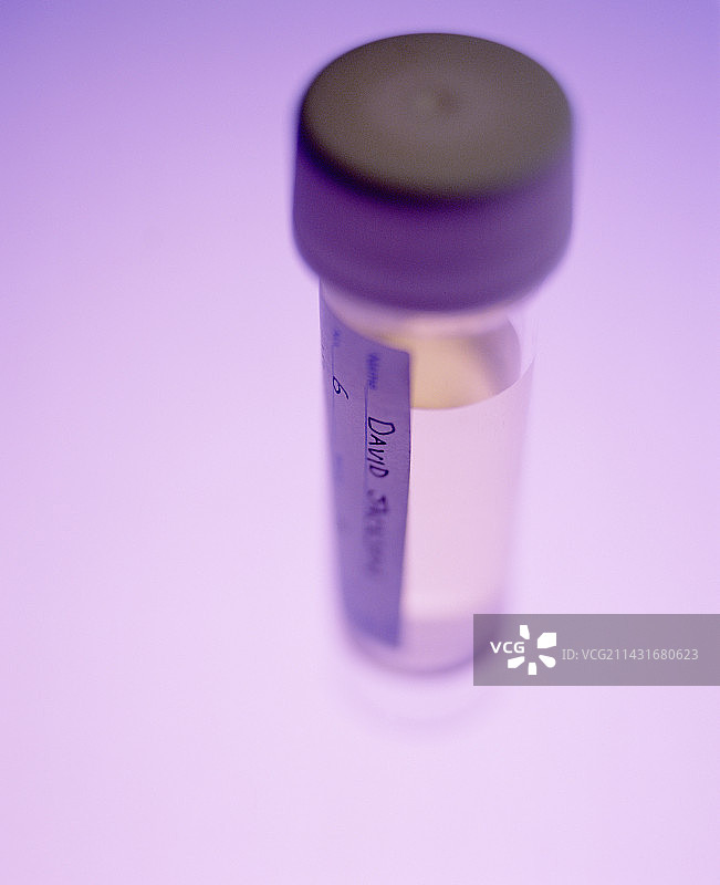 尿液样本图片素材