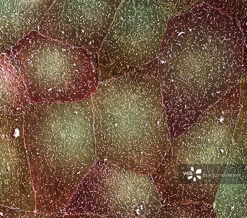 腭部内衬扫描电镜图图片素材