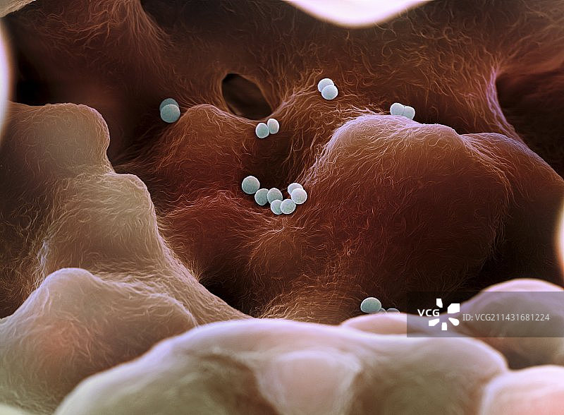 耐甲氧西林金黄色葡萄球菌，扫描电镜图片素材