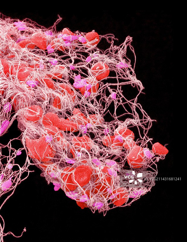 血栓扫描电镜图片素材