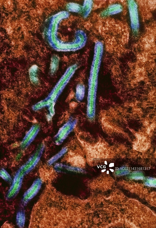 埃博拉病毒TEM图片素材