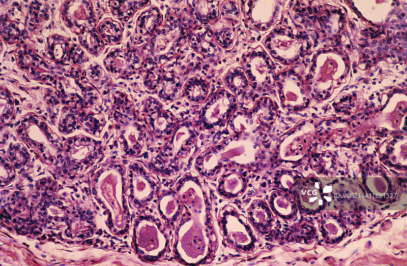 人乳腺显微照片图片素材
