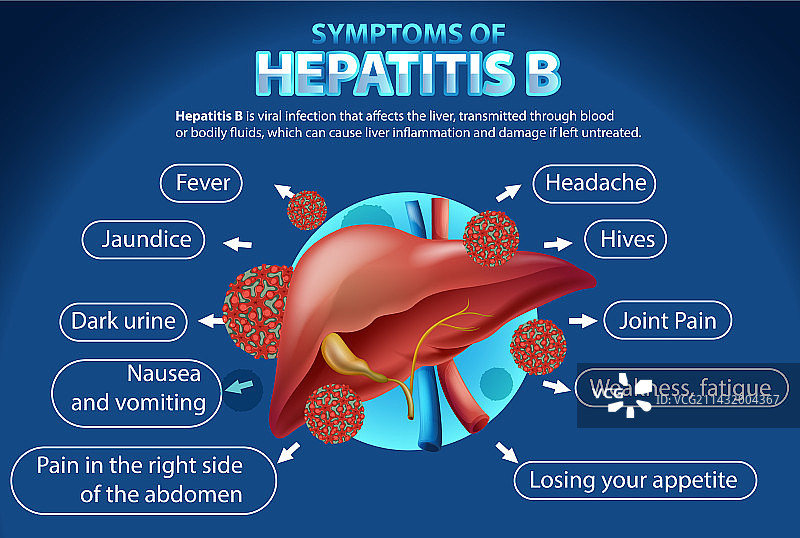 乙型肝炎症状信息图图片素材