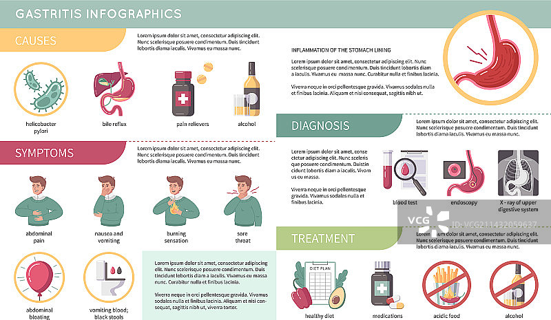 胃食管反流病扁平化信息图图片素材