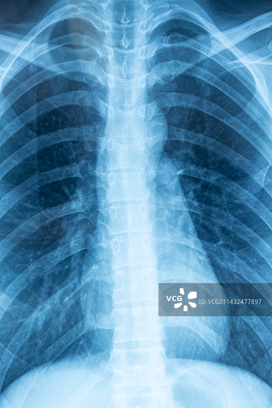 脊椎X光片图片素材