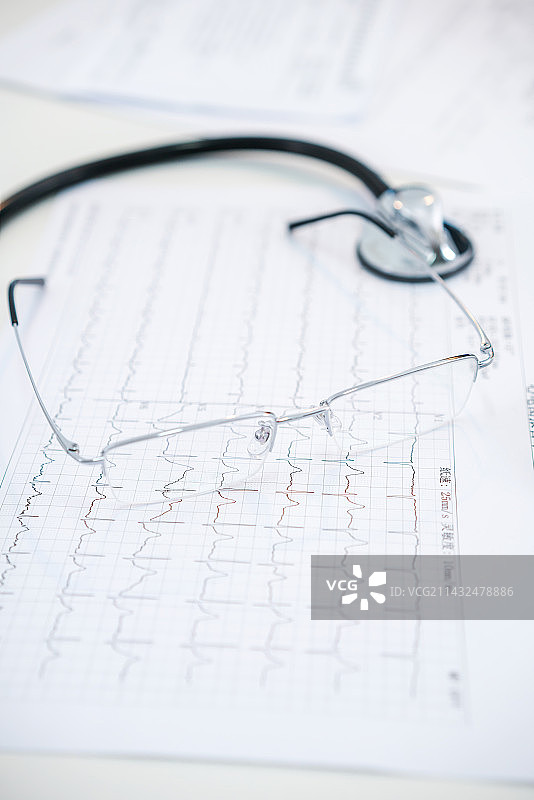 心率图表上的听诊器图片素材