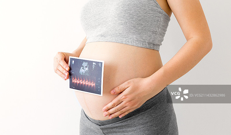 一位年轻孕妇手拿着一张胎儿B超照图片素材