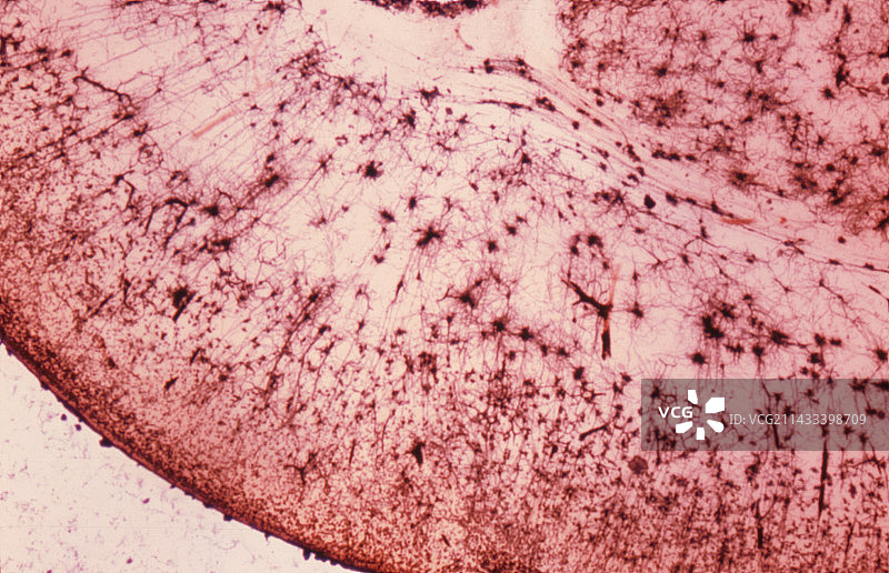 高尔基皮层图片素材
