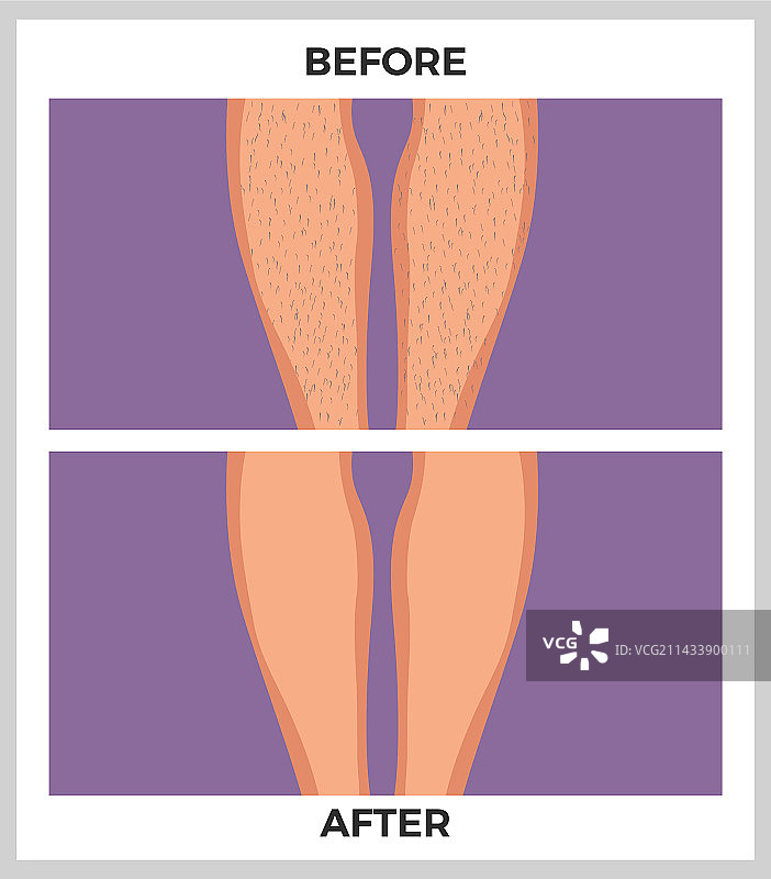 扁平风格脱毛图片素材