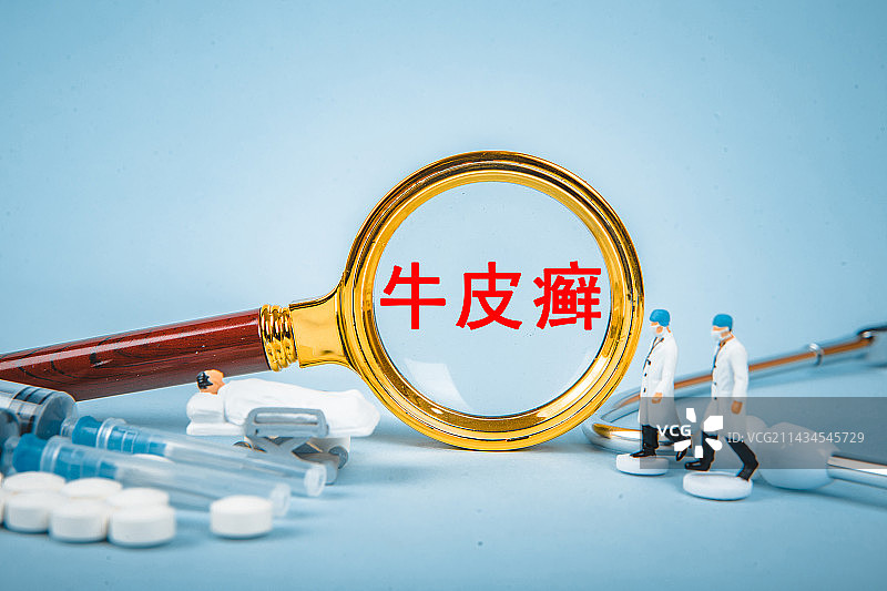 医疗创意配图：牛皮癣图片素材