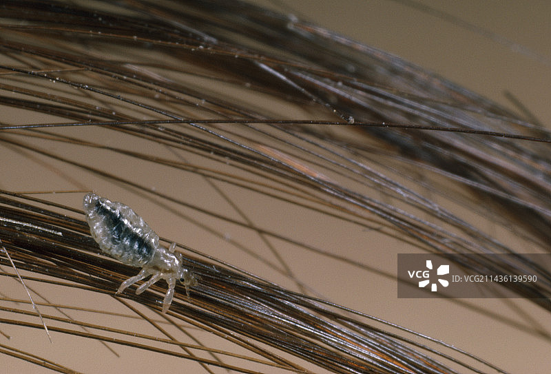 头发上的头虱图片素材