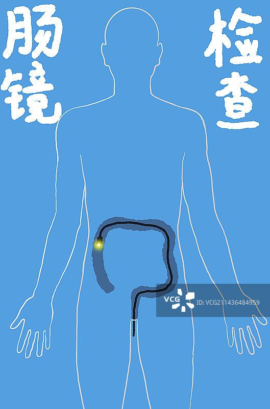 肠镜检查图片素材