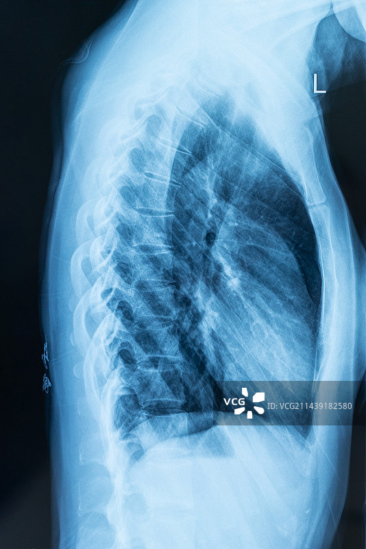 脊椎X光片图片素材