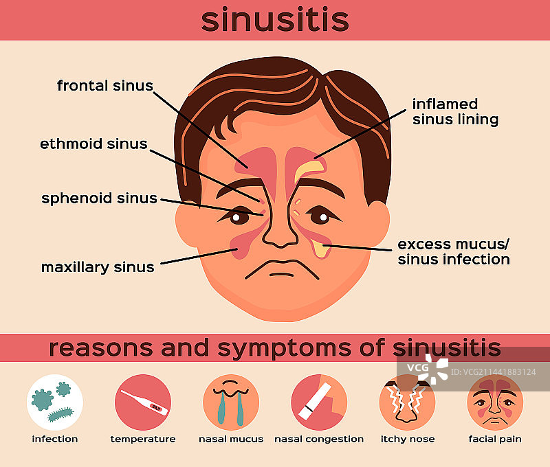 鼻窦炎扁平化信息图图片素材