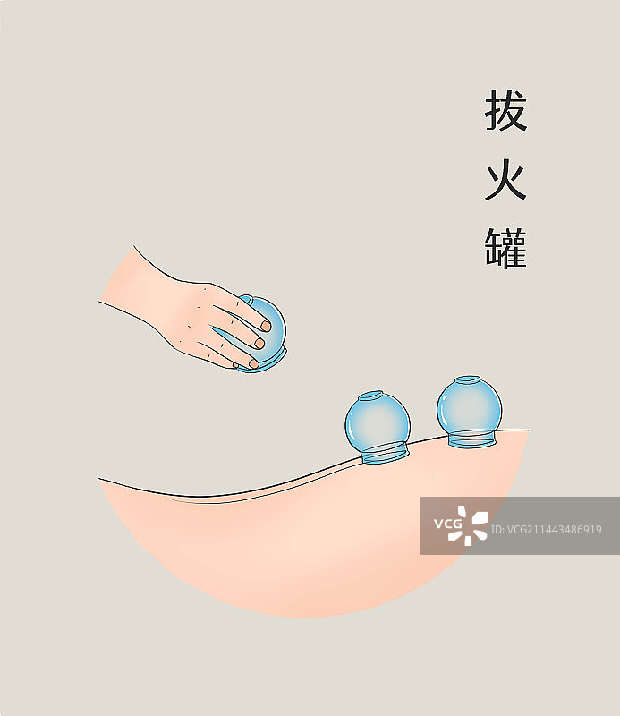 中医养生拔火罐图片素材