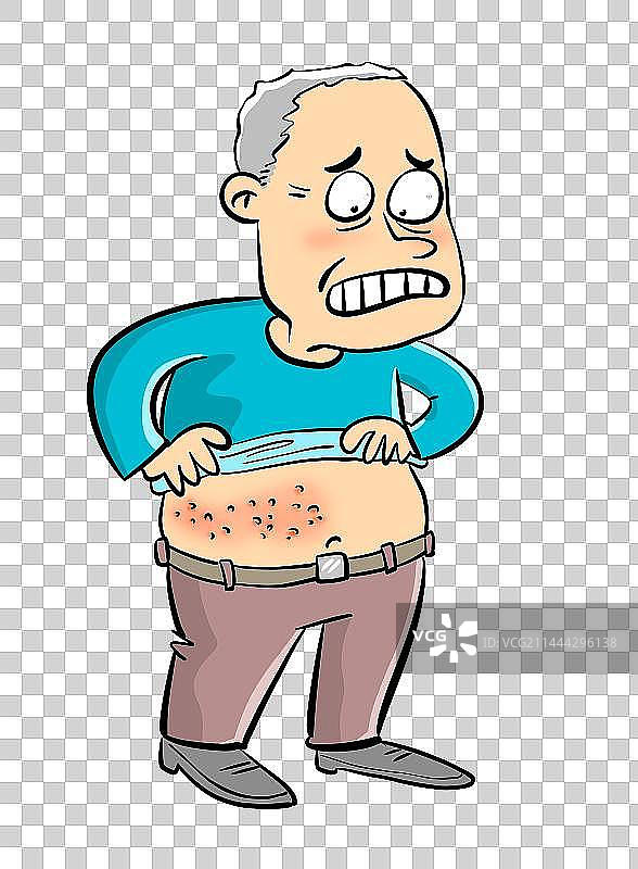 带状疱疹图片素材