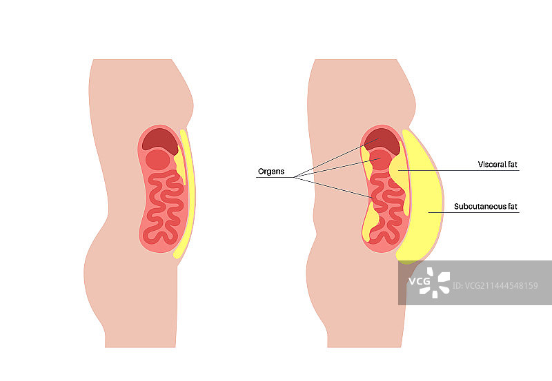 内脏脂肪图图片素材