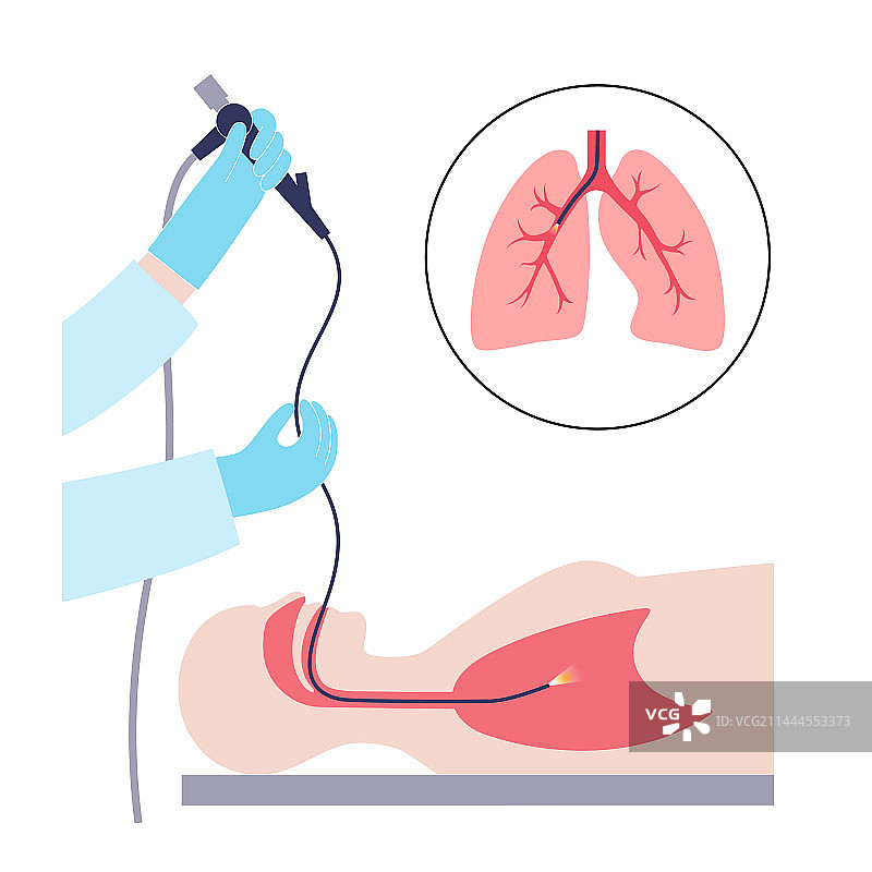 支气管镜检查概念图片素材