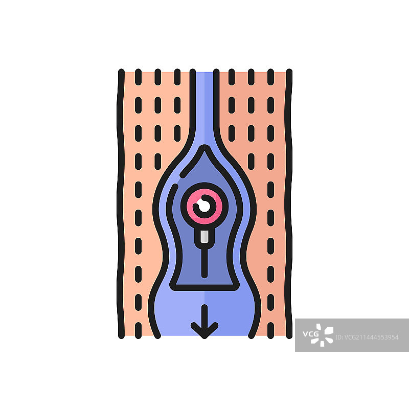 静脉曲张血流示意图轮廓图标图片素材