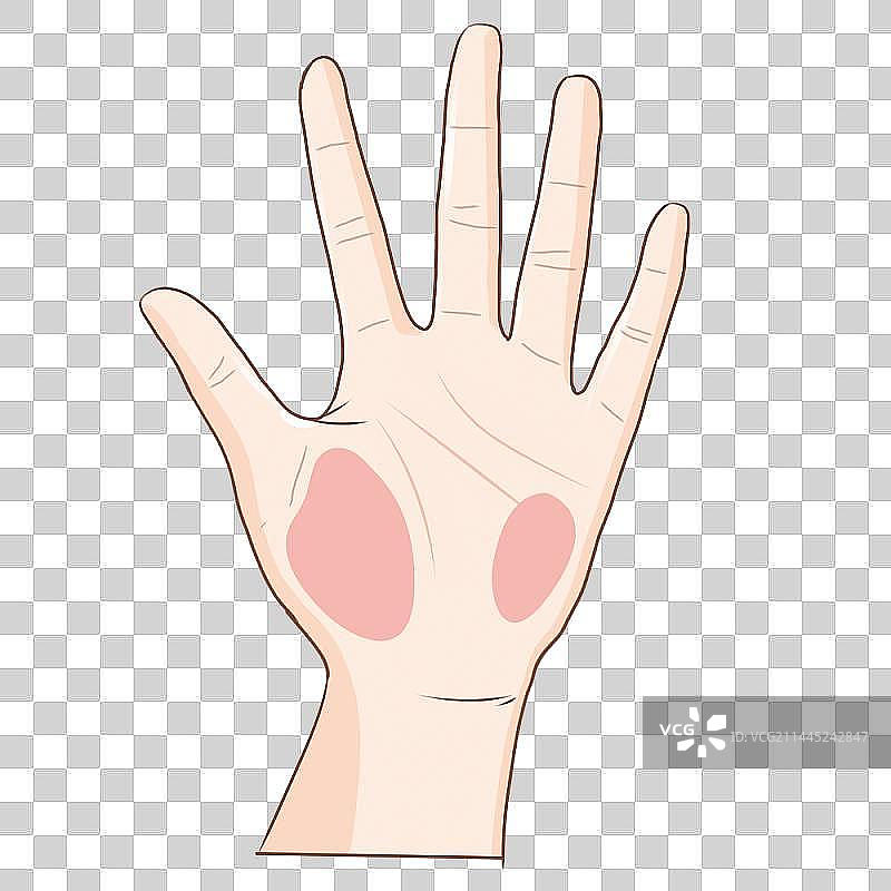 中医 穴位 养生 按摩 手 四肢 大鱼际穴 小鱼际穴图片素材