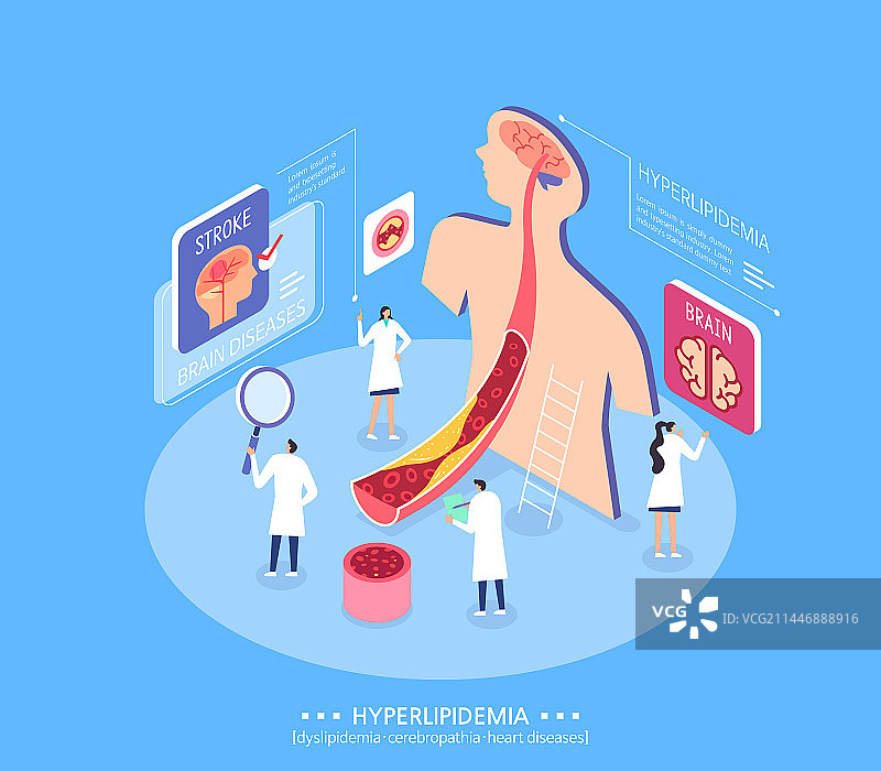 血管、医生、医疗保健、胆固醇、高脂血症、动脉硬化、大脑图片素材