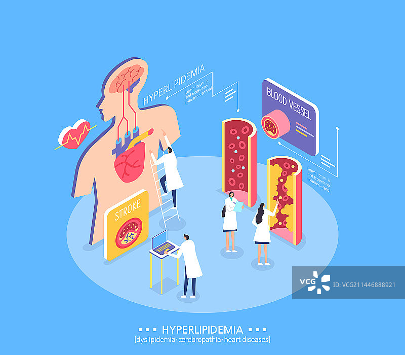血管医生医疗胆固醇高血脂解剖大脑心脏图片素材