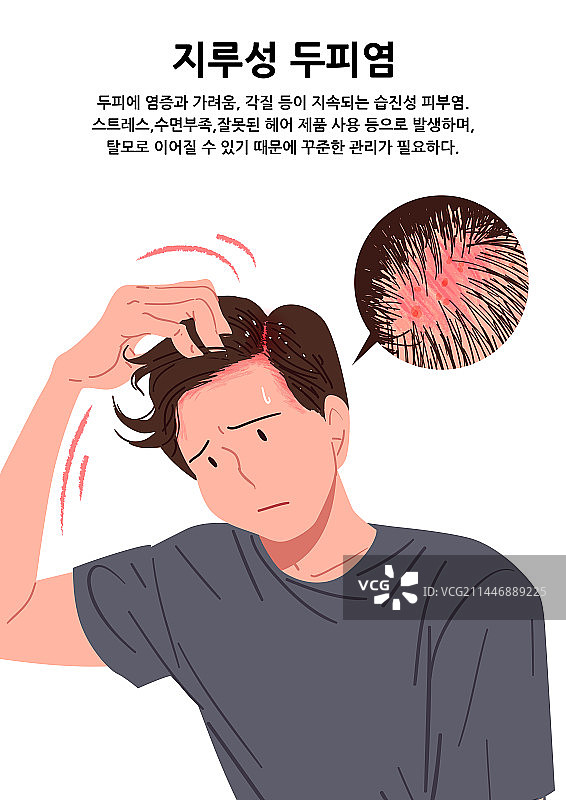 皮炎、皮肤问题、压力、疾病图片素材
