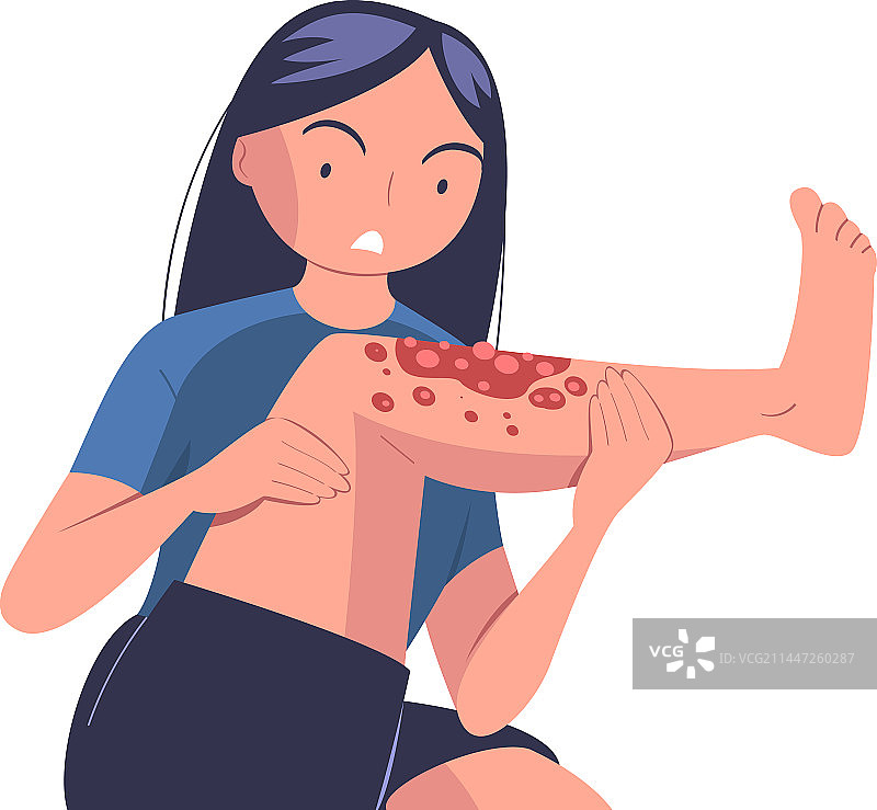 有皮肤问题的痛苦女人形象图片素材