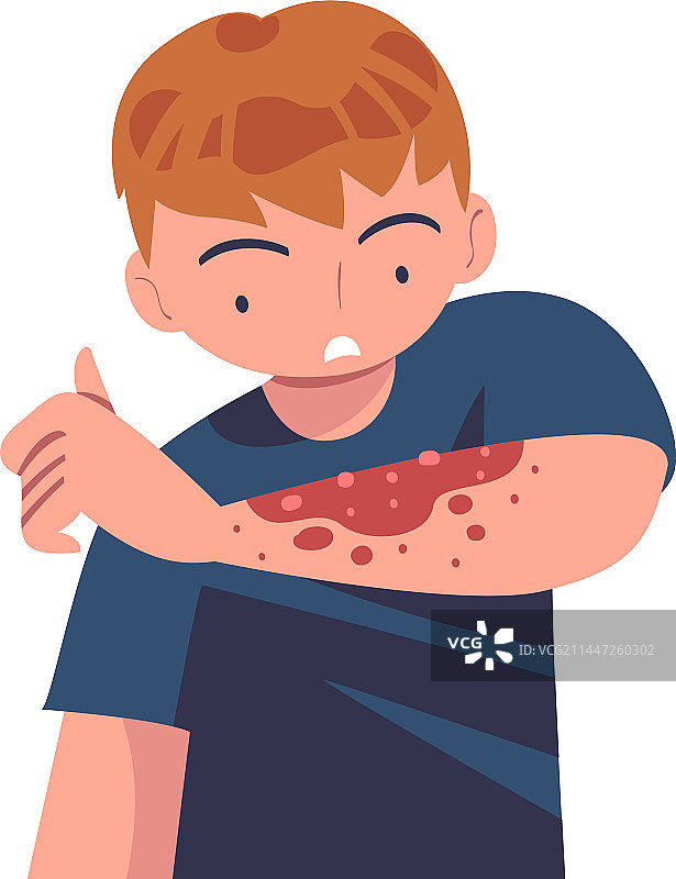 患有皮肤问题的男人图片素材