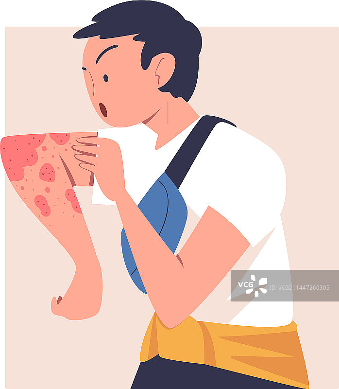 有皮肤问题的男人图片素材