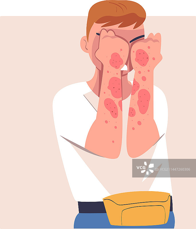 患有皮肤问题的男人图片素材