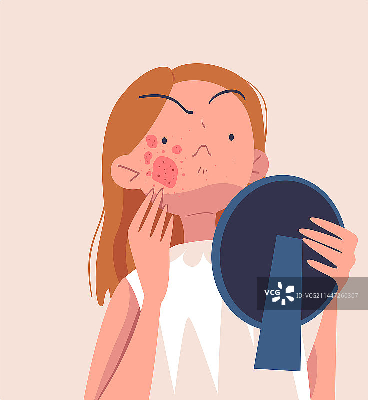 有皮肤问题的女性角色图片素材