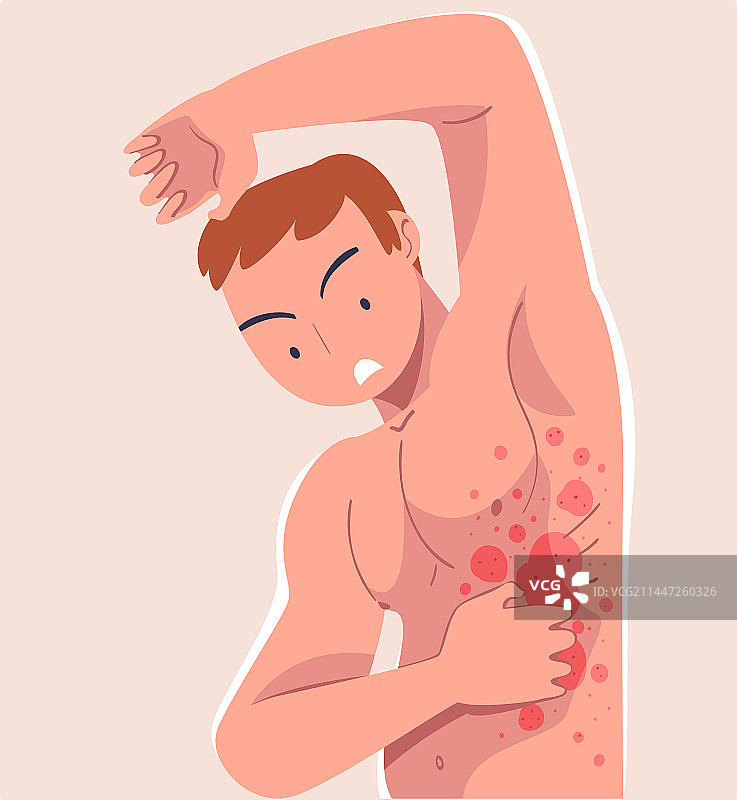 有皮肤问题的男人图片素材