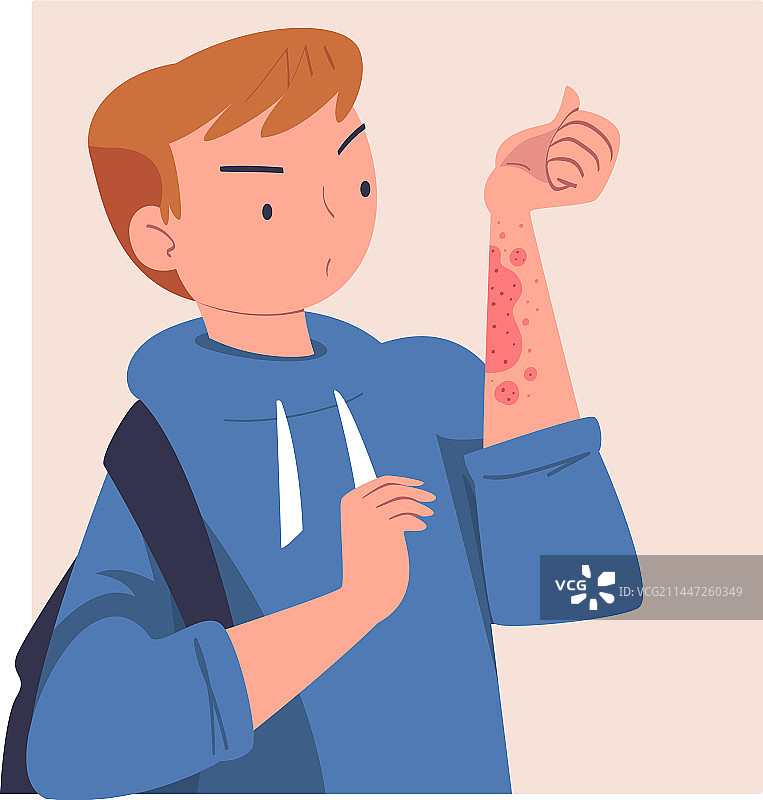 有皮肤问题的男人图片素材