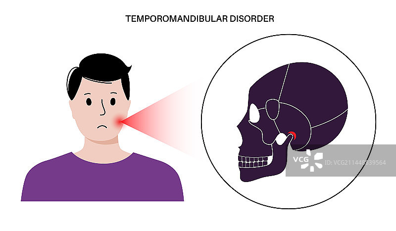 颞下颌关节紊乱图片素材