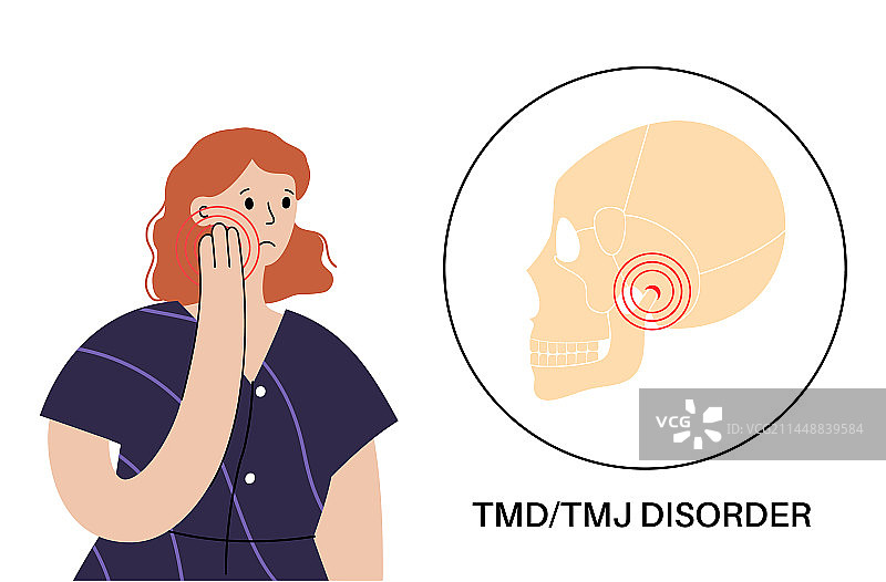 颞下颌关节紊乱图片素材