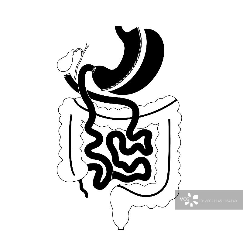 胆胰转流术图片素材