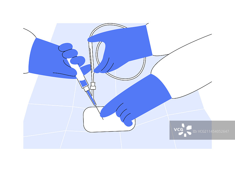 血管内手术抽象概念图片素材