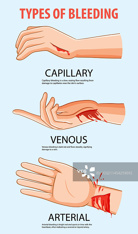 不同类型出血的人手图片素材