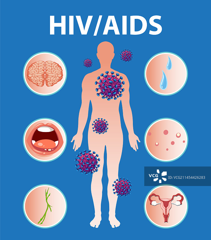 艾滋病毒对免疫系统和身体的影响图片素材