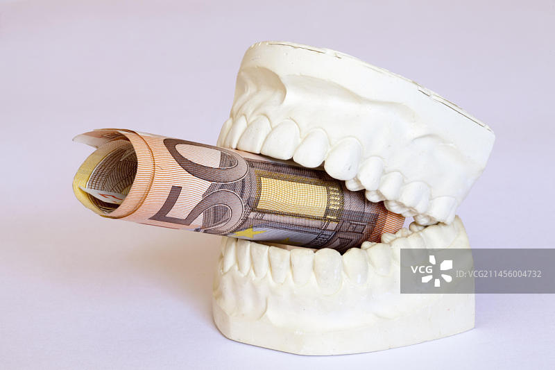 带有纸币的义齿石膏模型：昂贵牙科修复体的象征图片素材