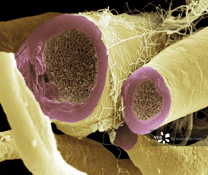 神经纤维扫描电镜照片图片素材